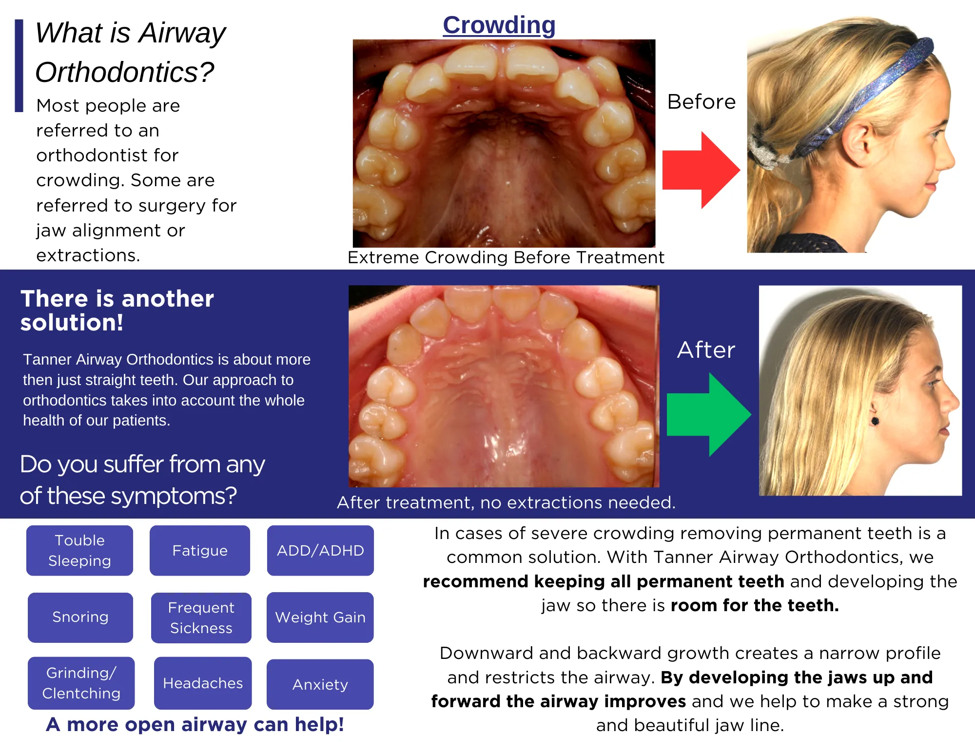 What does the Adult Dentition Tr-Fold Brochure look like? image