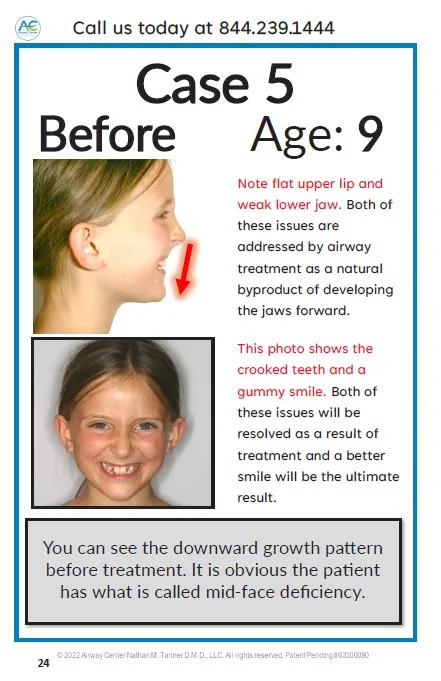 orthodontic dental before and after