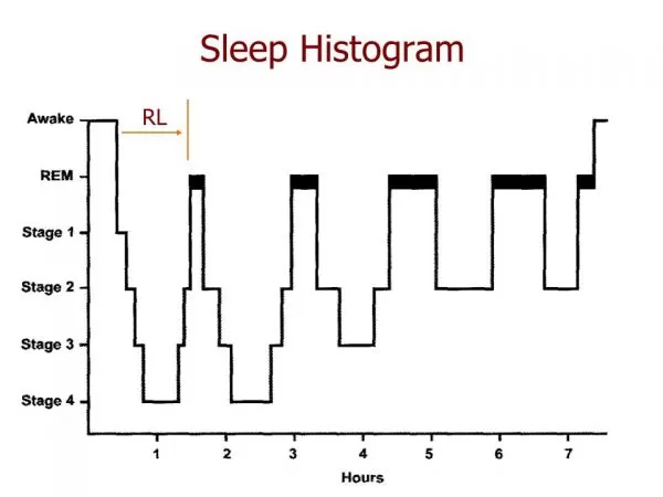 graphic for What are the stages of sleep?