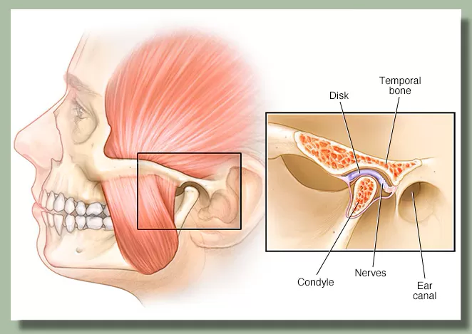 graphic for What are TMJ disorders?